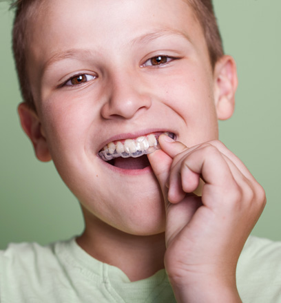 Invisalign® for kids