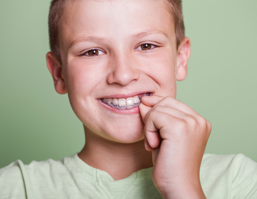 Invisalign® for kids